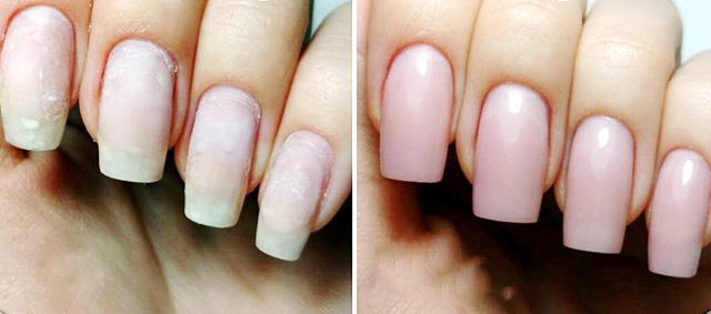 Восстановление ногтей